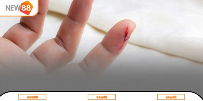 Nằm mơ thấy đứt tay theo quan niệm dân gian và thực tế